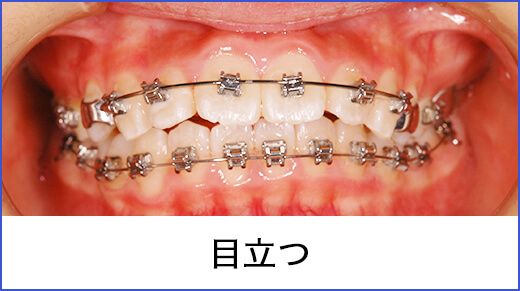 見た目 目立つ