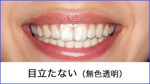 見た目 目立たない