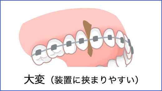 大変（装置に挟まりやすい）
