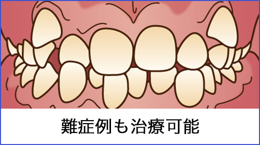 難症例も可能