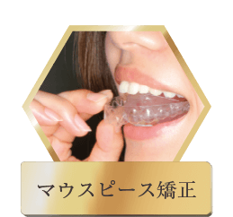 マウスピース矯正